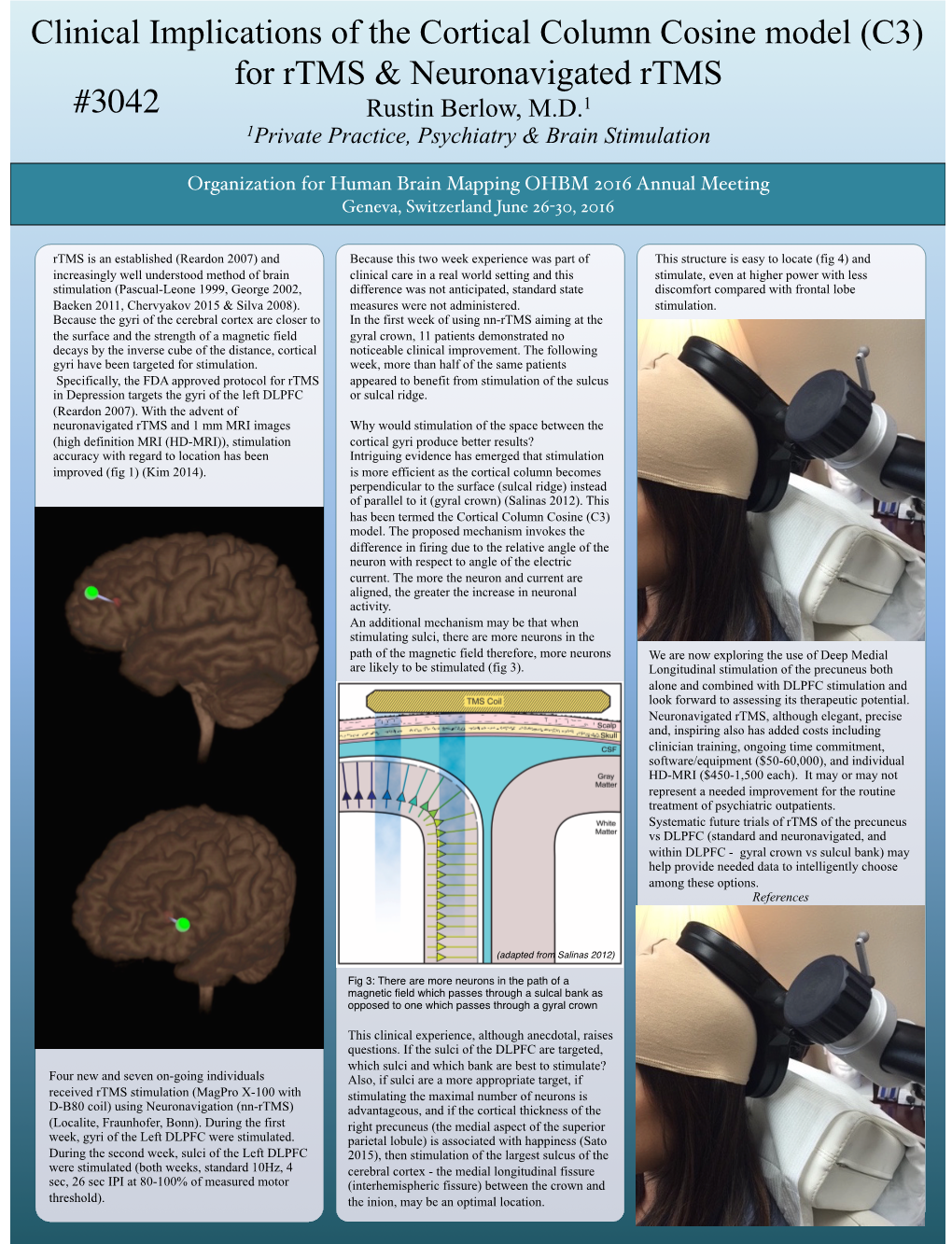 Clinical Implications of the Cortical Column Cosine Model