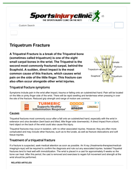 Triquetrum Fracture | Symptoms and Treatment| Sportsinjuryclinic.Net