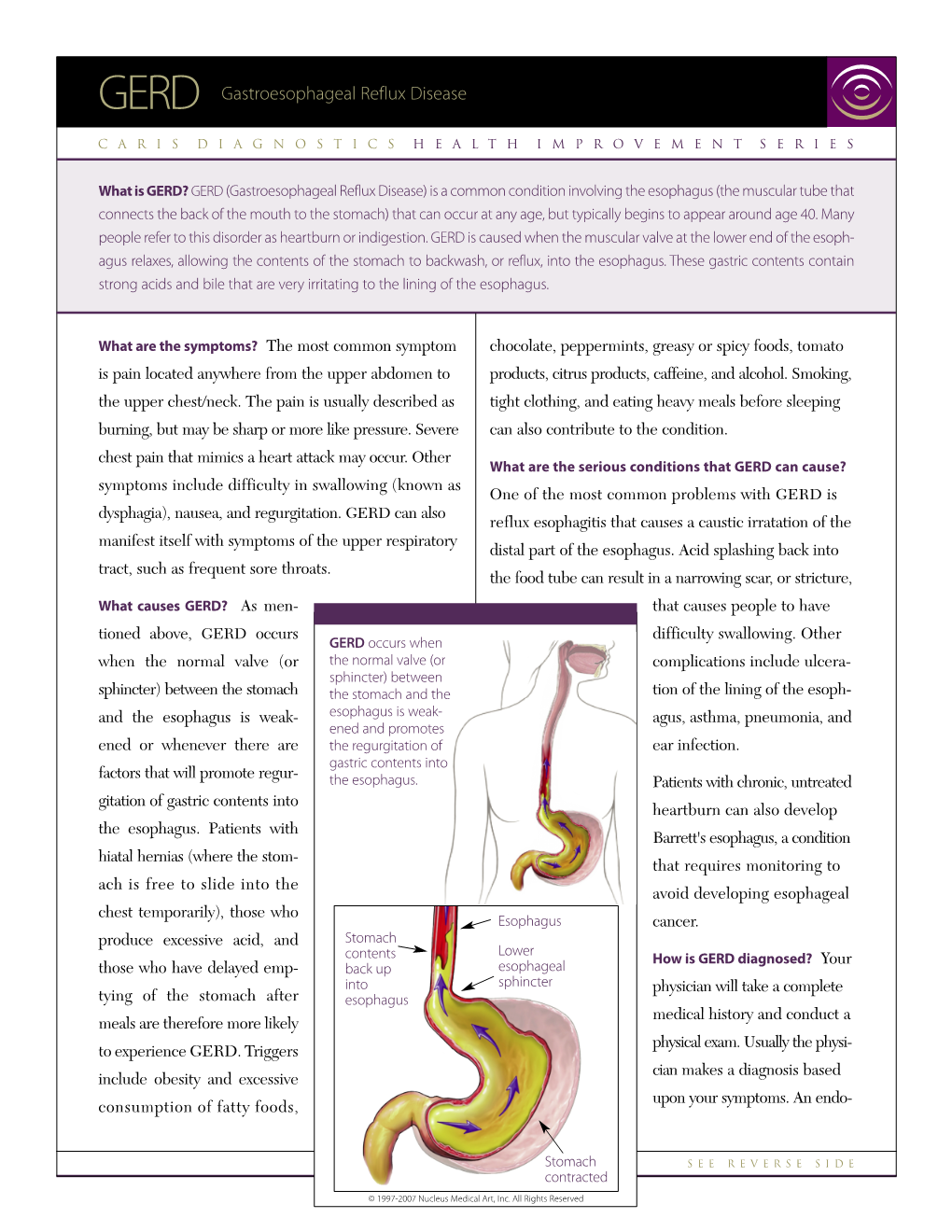 Gastroesophageal Reflux Disease