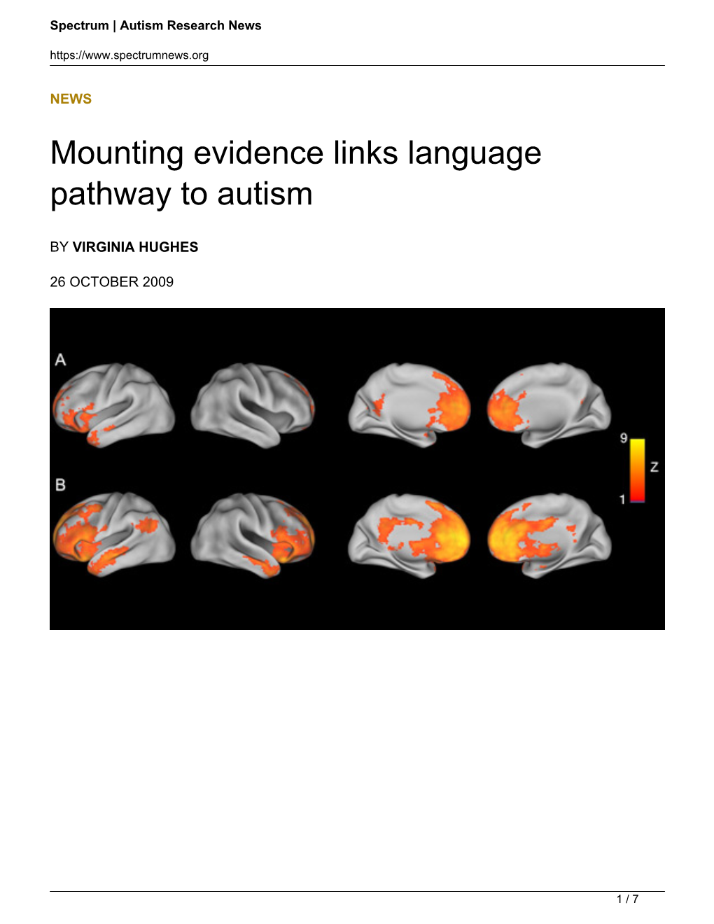 Mounting Evidence Links Language Pathway to Autism