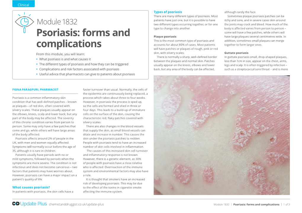 Psoriasis: Forms and Complications | 1 of 3 Appearance of Severe Dandruff