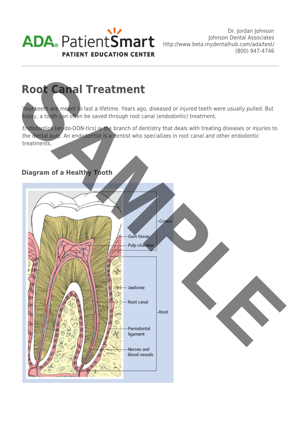 ADA Patient Smart | Root Canal Treatment