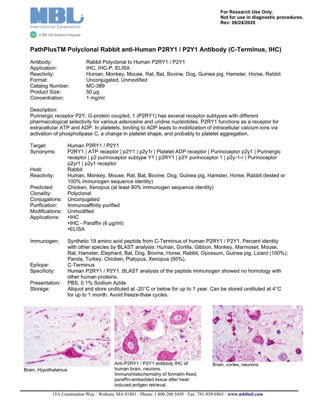 Pathplustm Polyclonal Rabbit Anti‑Human P2RY1 / P2Y1 Antibody (C‑Terminus, IHC)