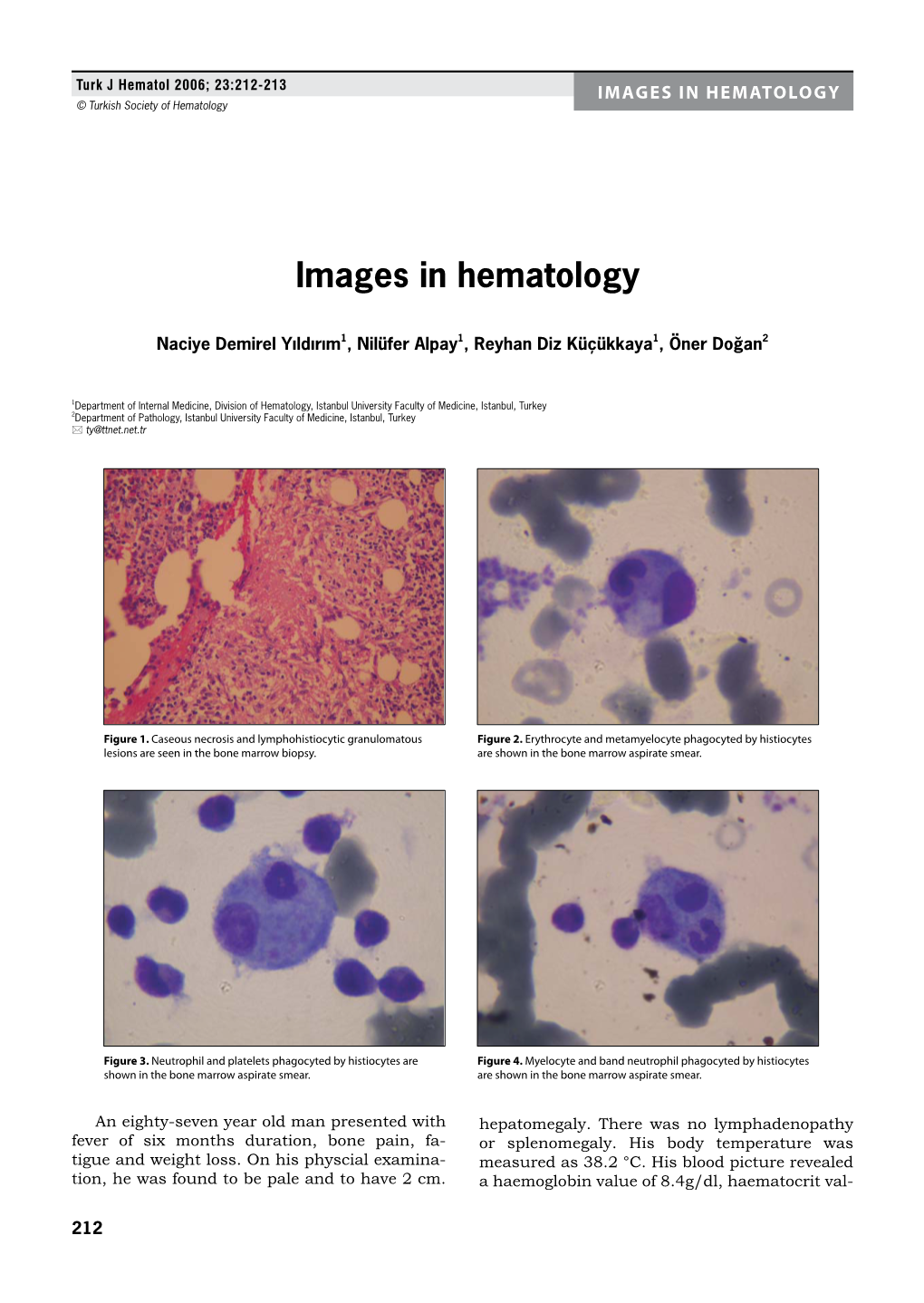 IMAGES in HEMATOLOGY © Turkish Society of Hematology