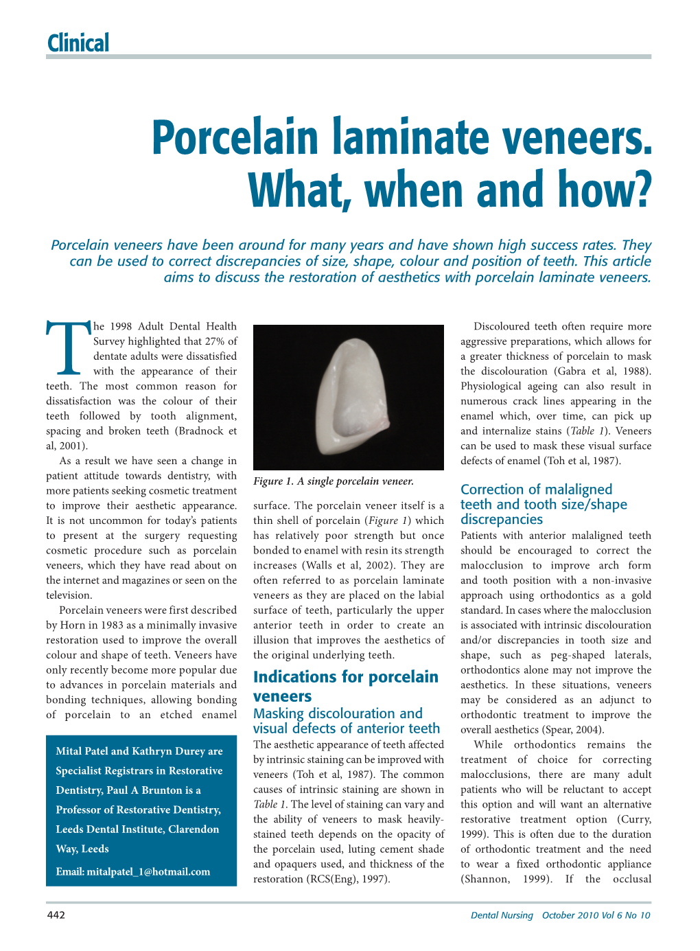 Porcelain Laminate Veneers. What, When and How?