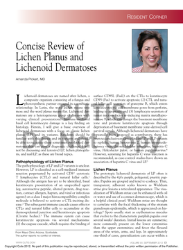 Concise Review of Lichen Planus and Lichenoid Dermatoses