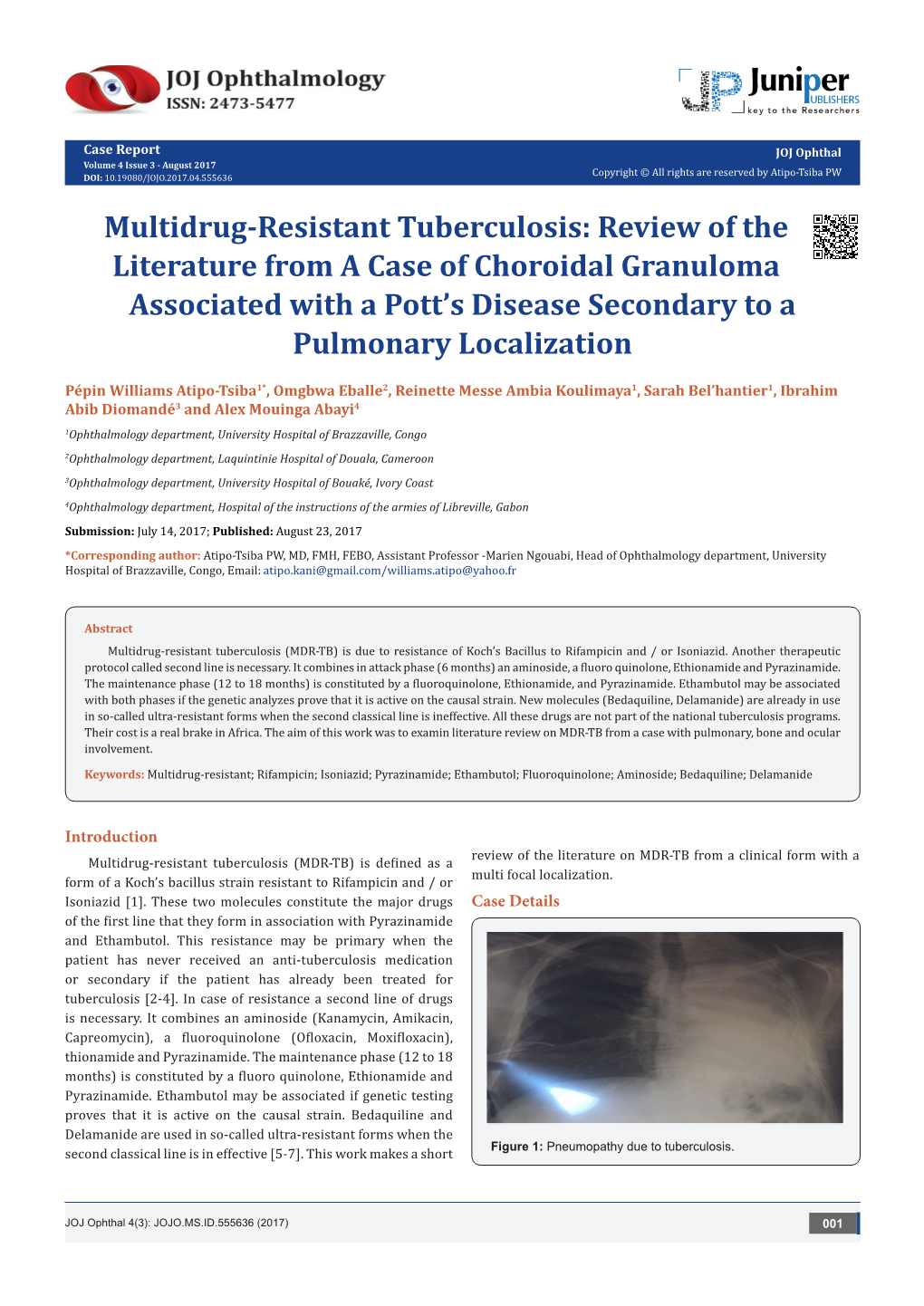 literature review of pulmonary tuberculosis