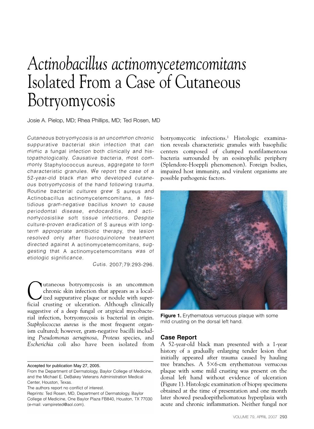 Actinobacillus Actinomycetemcomitans Isolated from a Case of Cutaneous Botryomycosis