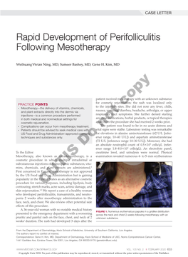 Rapid Development of Perifolliculitis Following Mesotherapy