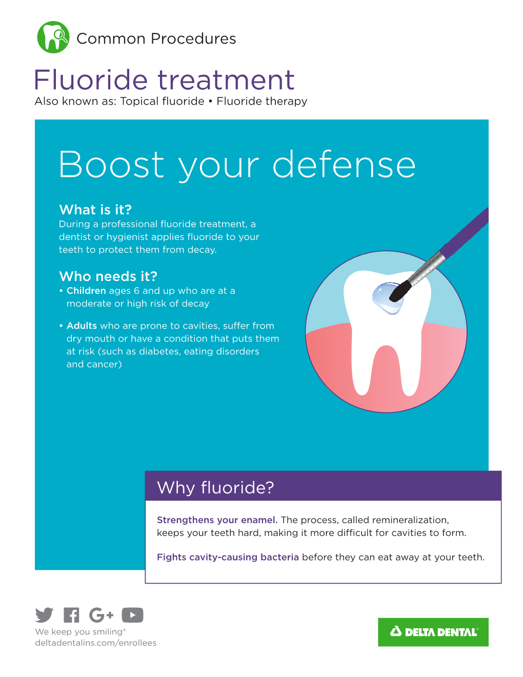 Fluoride Treatment Also Known As: Topical Fluoride • Fluoride Therapy