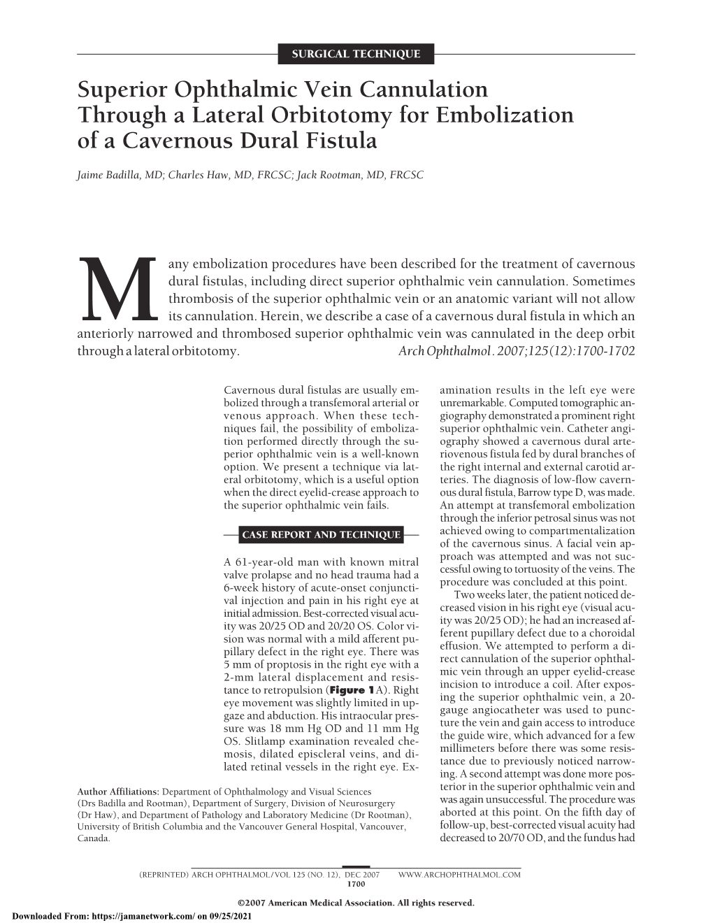 Superior Ophthalmic Vein Cannulation Through a Lateral Orbitotomy for Embolization of a Cavernous Dural Fistula