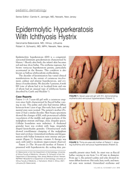 Epidermolytic Hyperkeratosis with Ichthyosis Hystrix Geromanta Baleviciené, MD, Vilnius, Lithuania Robert A