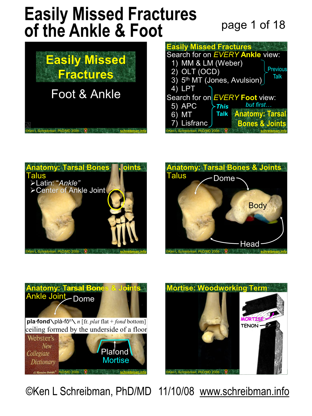 Easily Missed Fractures of the Ankle & Foot