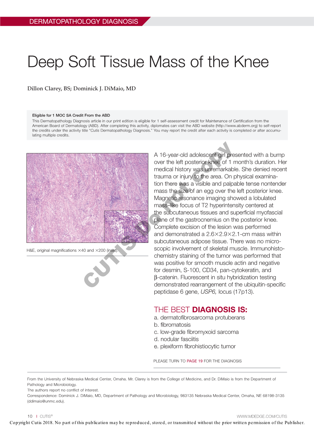 Deep Soft Tissue Mass of the Knee