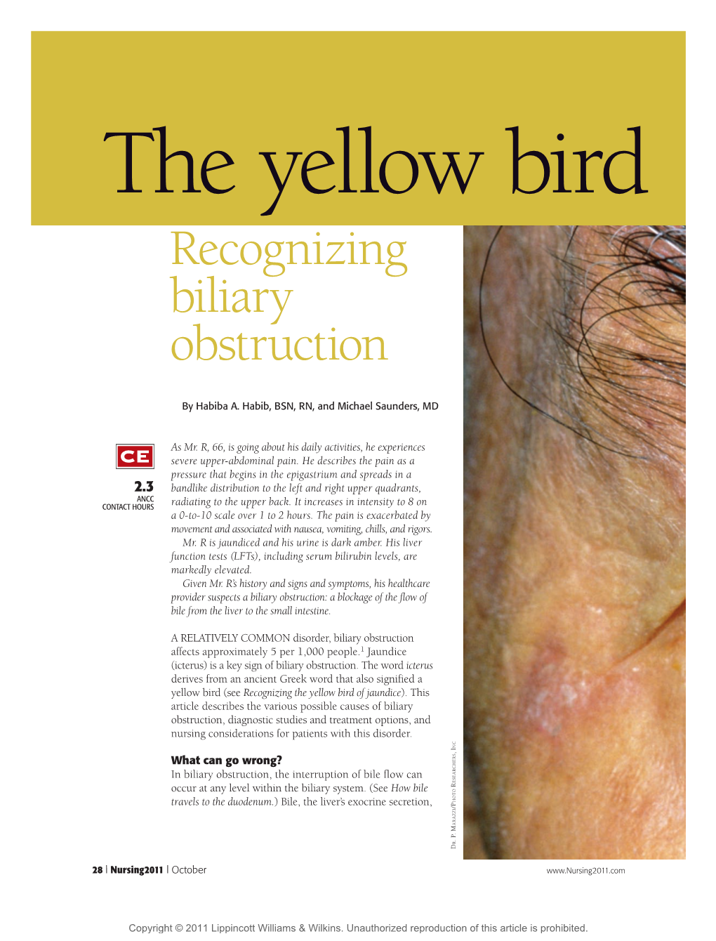 Recognizing Biliary Obstruction