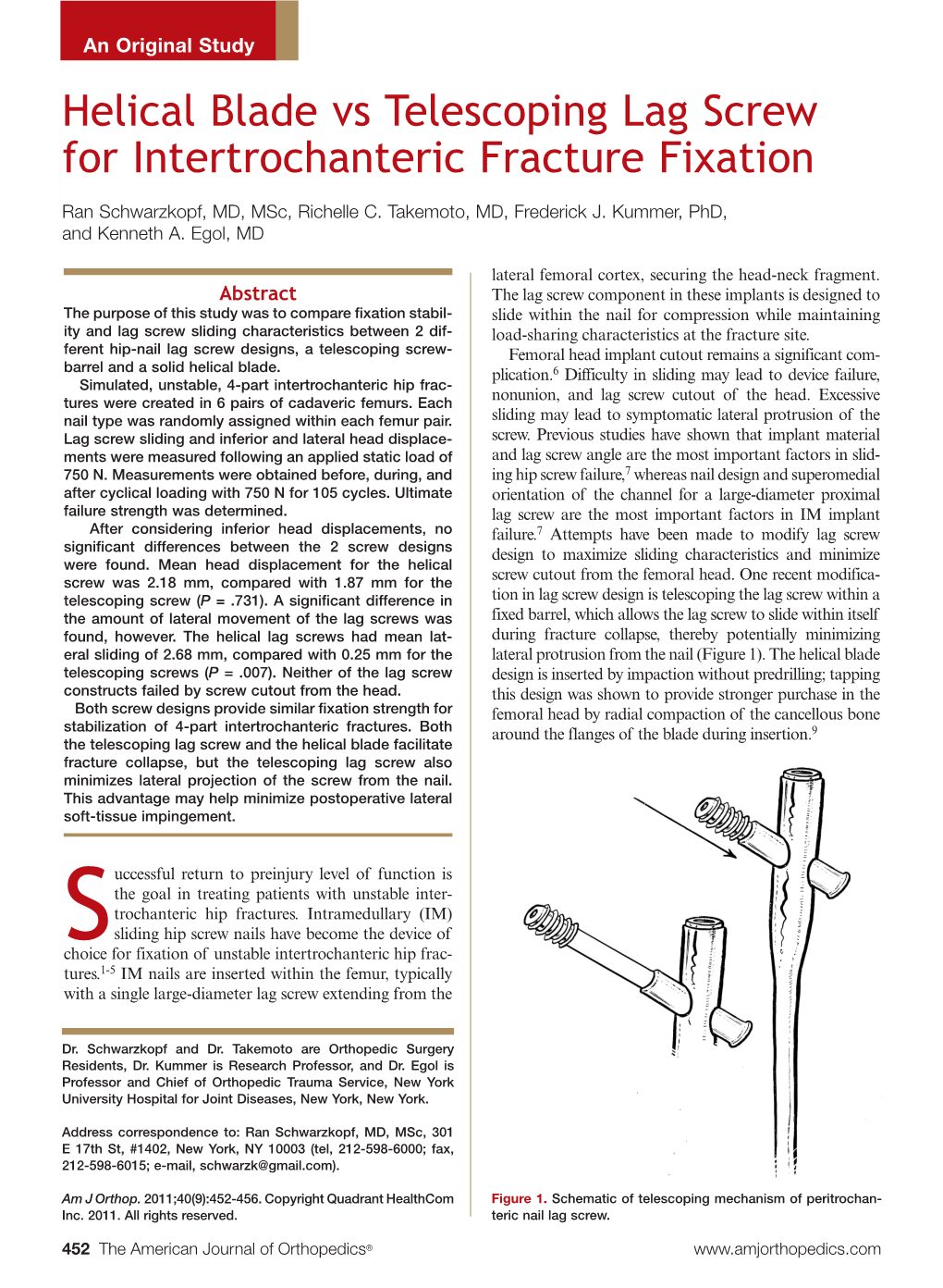 Helical Blade Vs Telescoping Lag Screw for Intertrochanteric Fracture Fixation