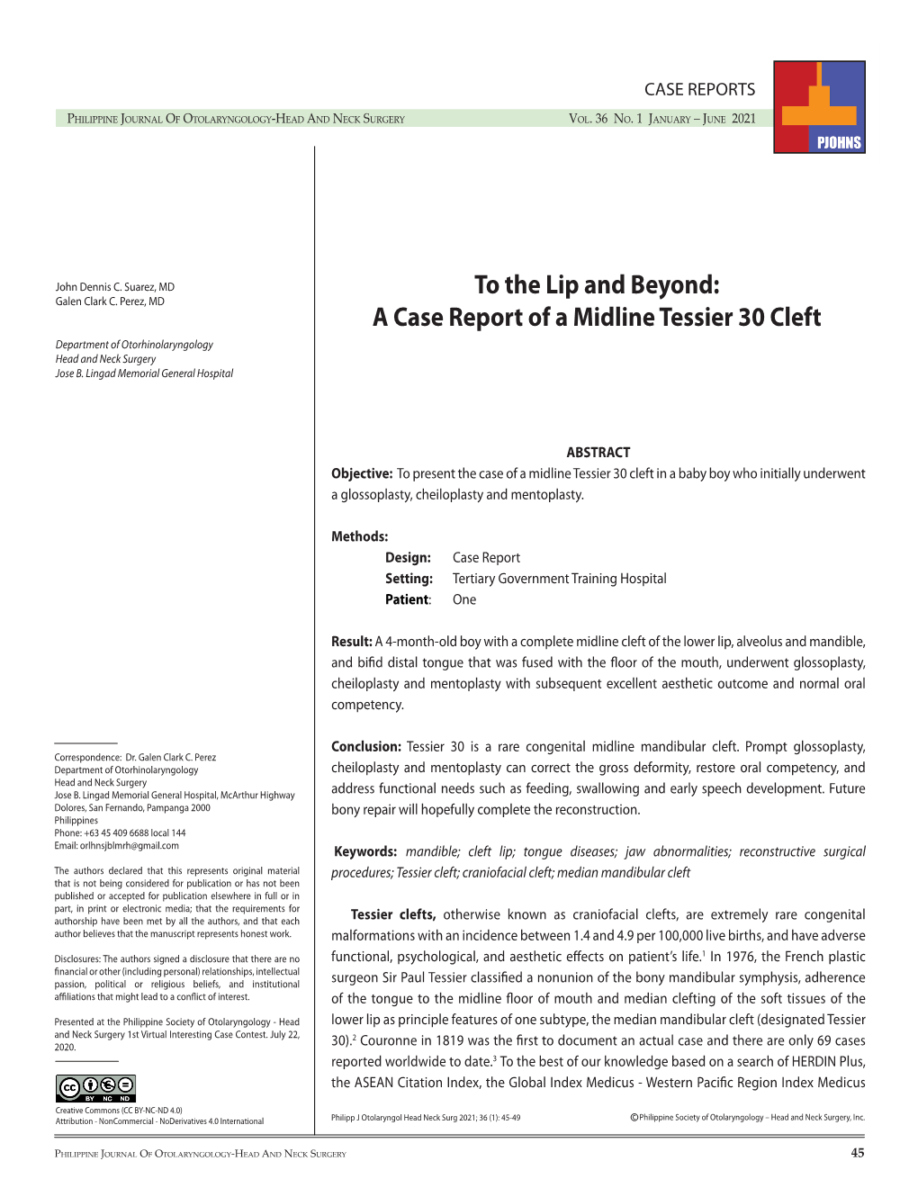 A Case Report of a Midline Tessier 30 Cleft Department of Otorhinolaryngology Head and Neck Surgery Jose B