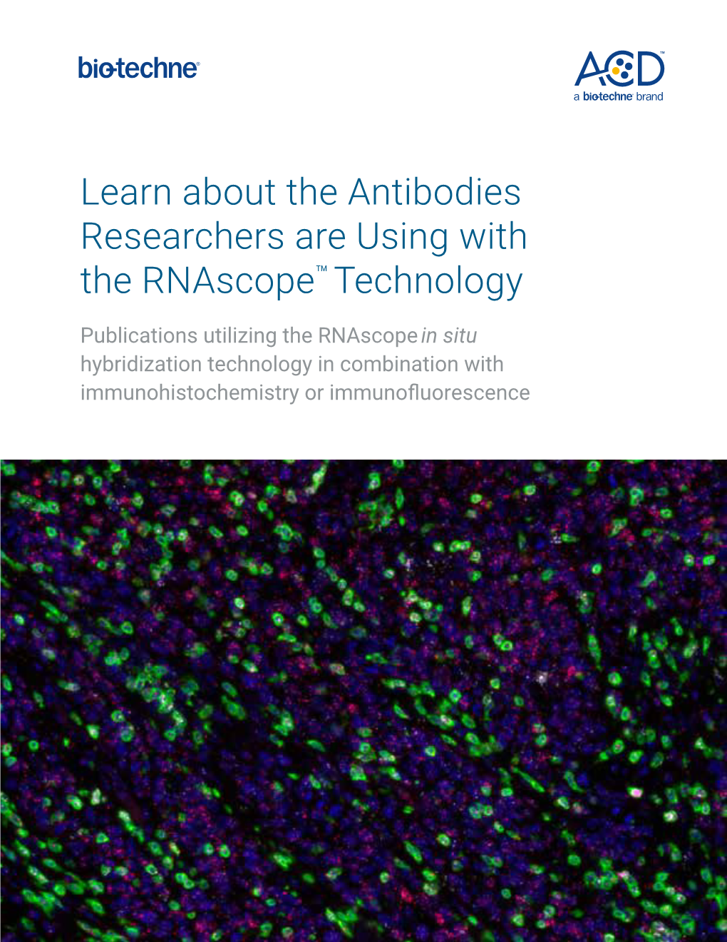 Learn About the Antibodies Researchers Are Using with the Rnascope™ Technology