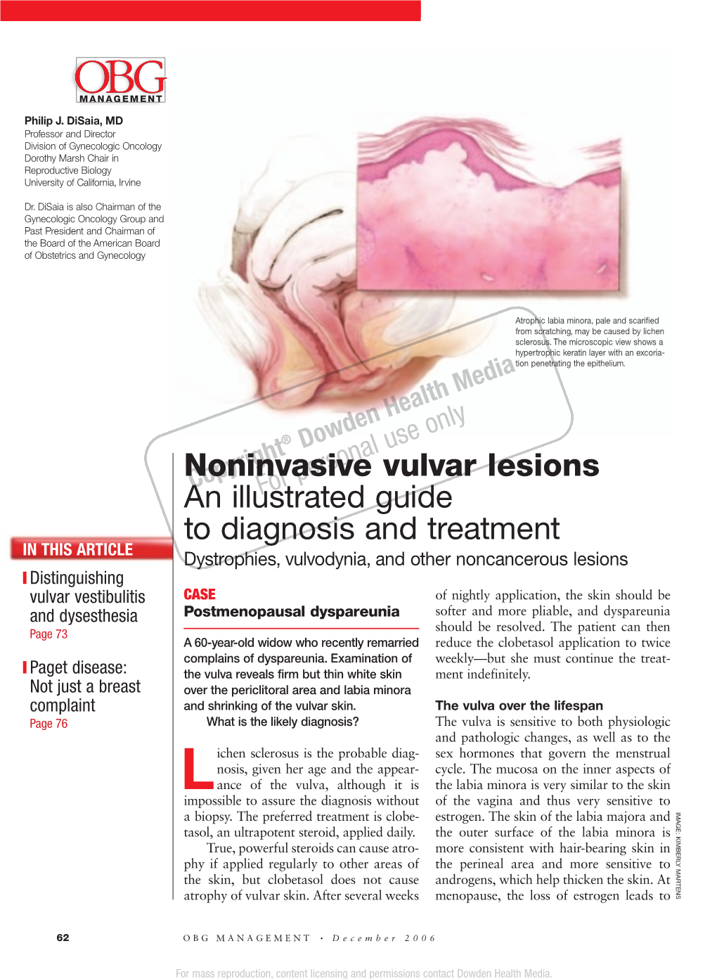 Noninvasive Vulvar Lesions an Illustrated Guide to Diagnosis and Treatment