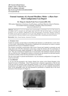 Unusual Anatomy of a Second Maxillary Molar - a Rare Four- Root Configuration Case Report