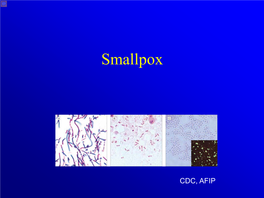 Smallpox Presentation