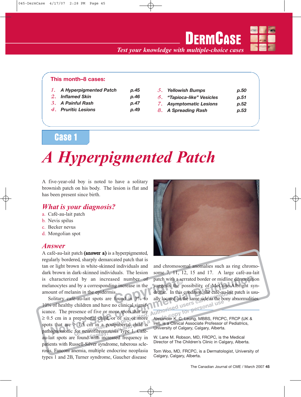 Dermcase 4/17/07 2:28 PM Page 45