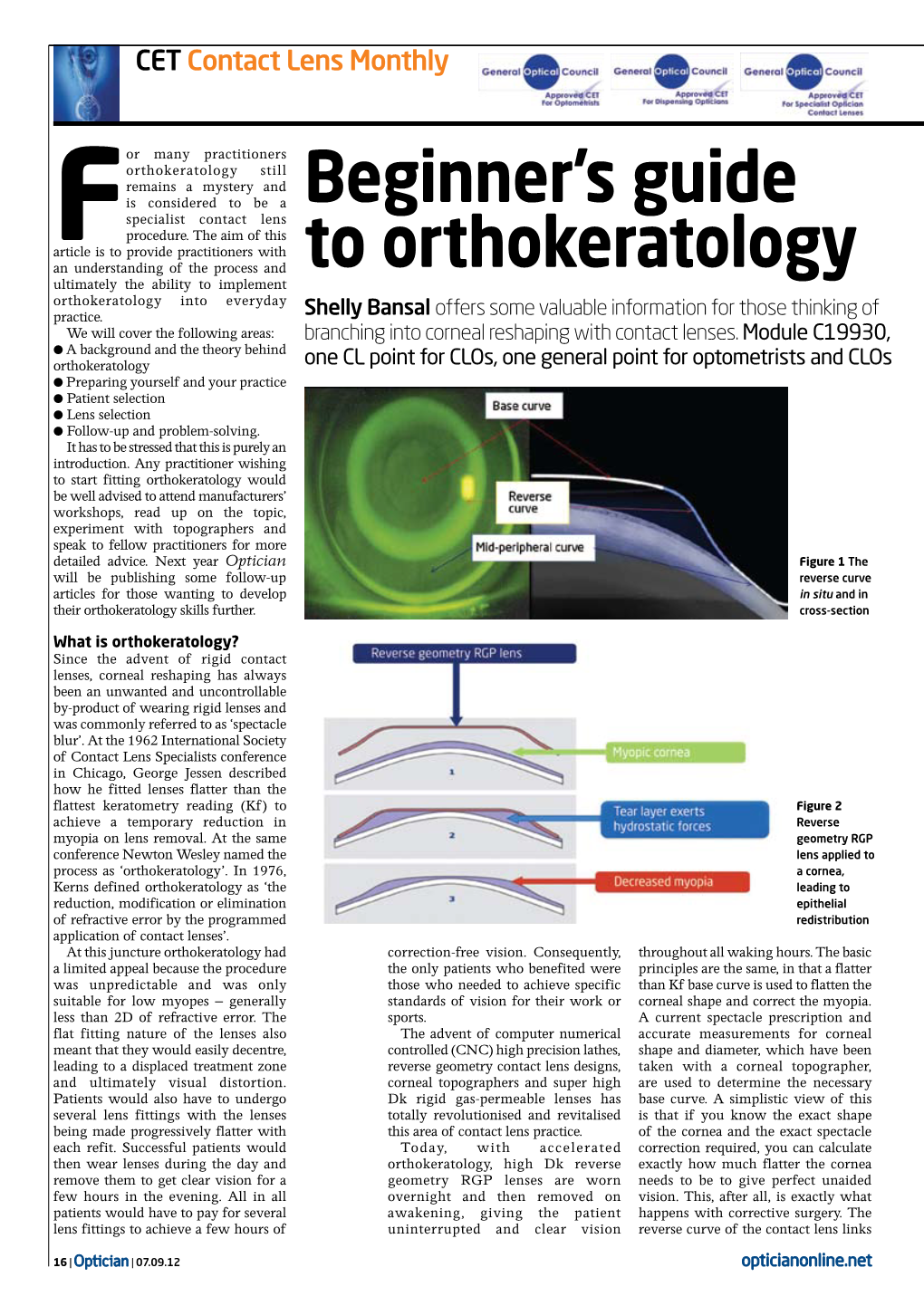 Beginner's Guide to Orthokeratology