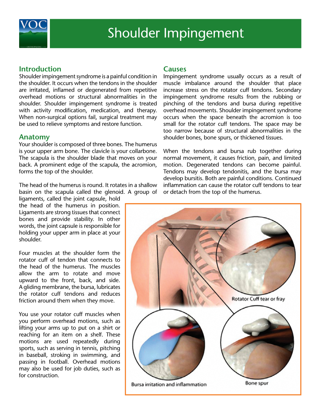 Shoulder Impingement