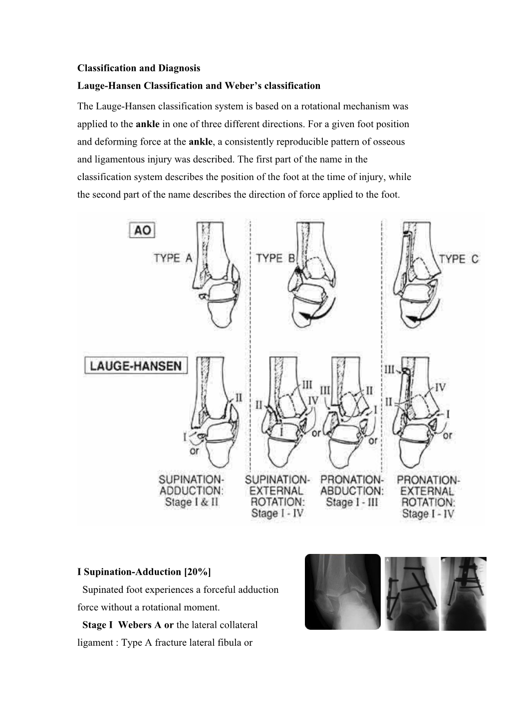 Ankle Fracture Classification