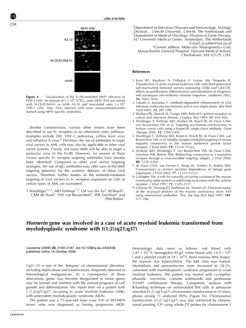 Hornerin Gene Was Involved in a Case of Acute Myeloid Leukemia Transformed from Myelodysplastic Syndrome with T(1;2)(Q21;Q37)