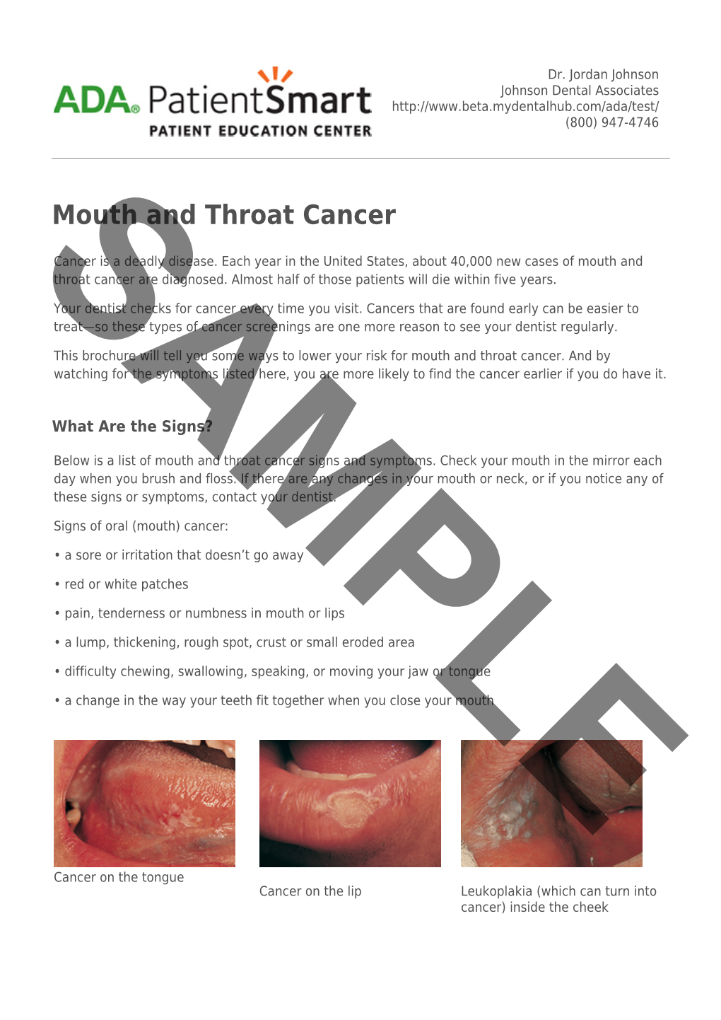 Mouth and Throat Cancer