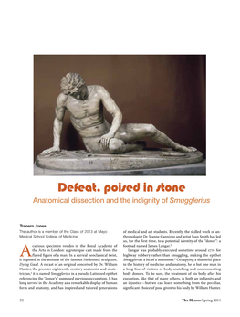 Defeat, Poised in Stone Anatomical Dissection and the Indignity of Smugglerius
