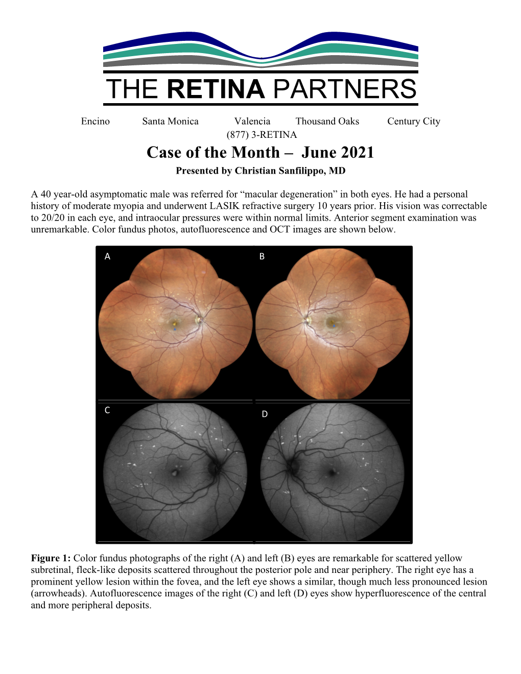 Case of the Month – June 2021 Presented by Christian Sanfilippo, MD