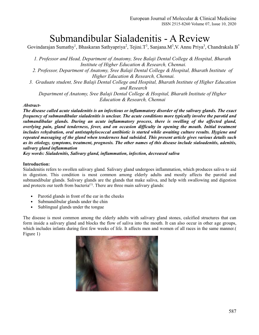 Submandibular Sialadenitis - a Review Govindarajan Sumathy1, Bhaskaran Sathyapriya2, Tejini.T3, Sanjana.M3,V