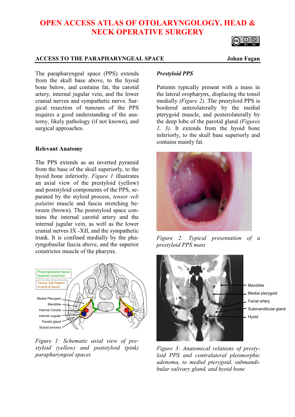 PARAPHARYNGEAL SPACE Johan Fagan