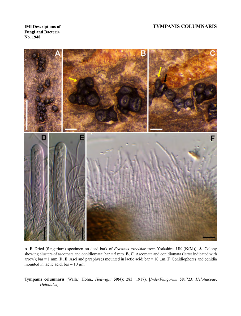 TYMPANIS COLUMNARIS Fungi and Bacteria No