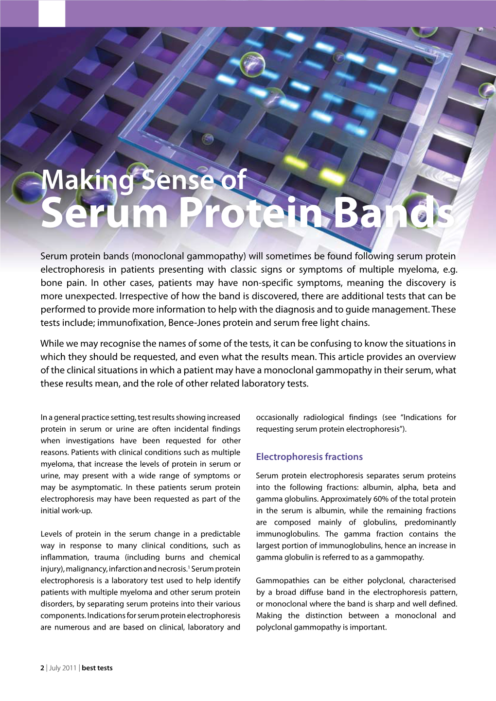 Serum Protein Bands