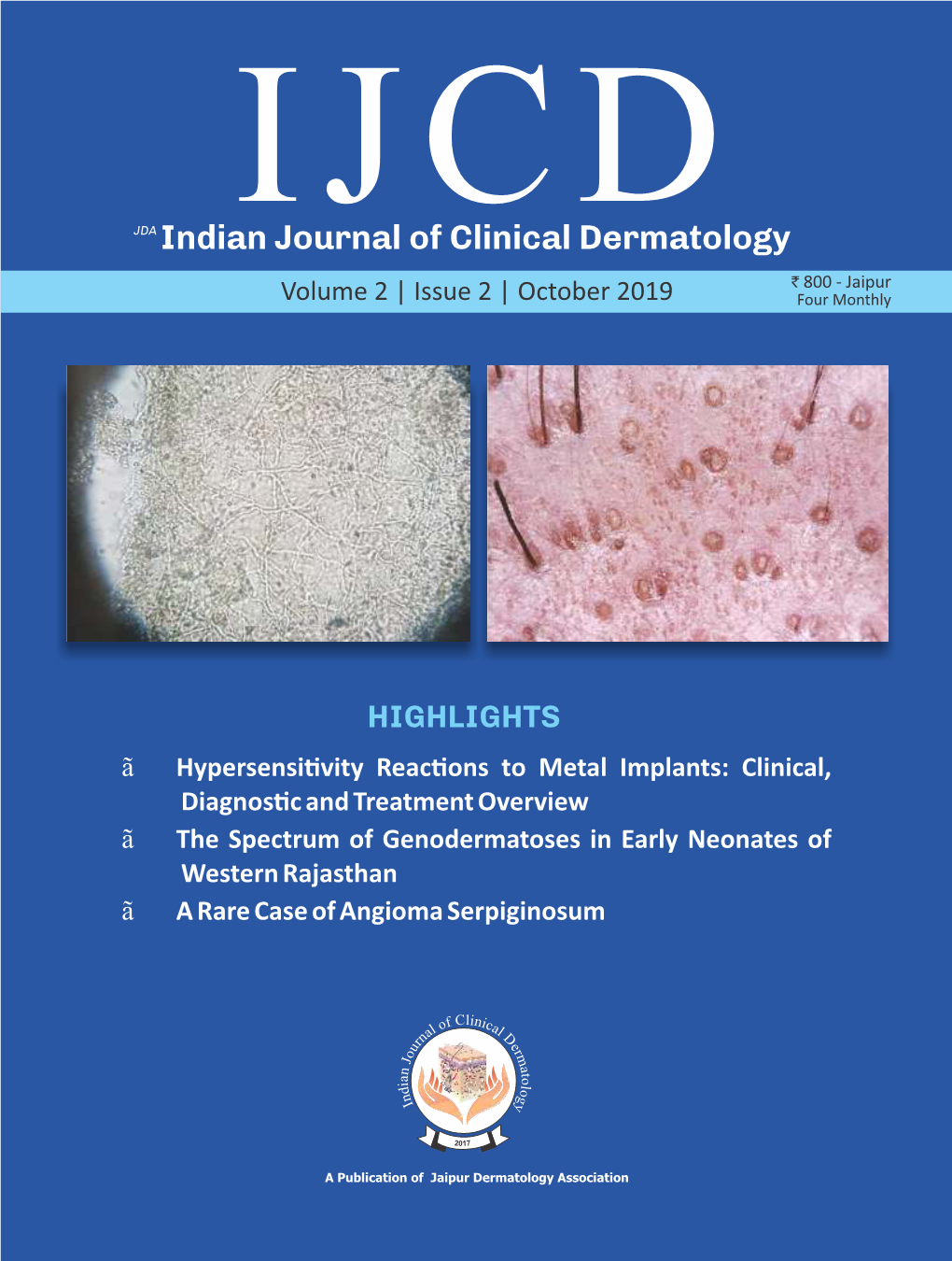IJCD Indian Journal of Clinical Dermatology