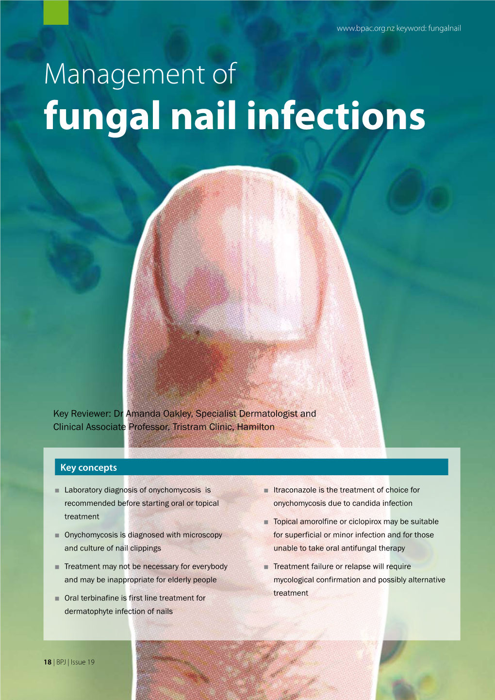 Fungal Nail Infections