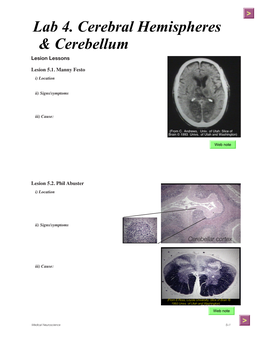 Lab 4. Cerebral Hemispheres & Cerebellum