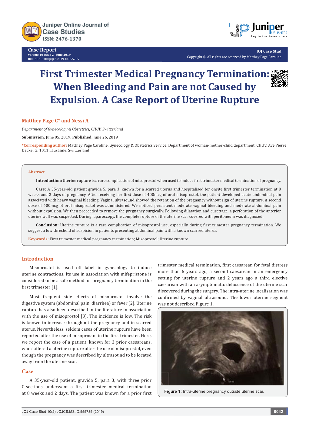 First Trimester Medical Pregnancy Termination: When Bleeding and Pain Are Not Caused by Expulsion
