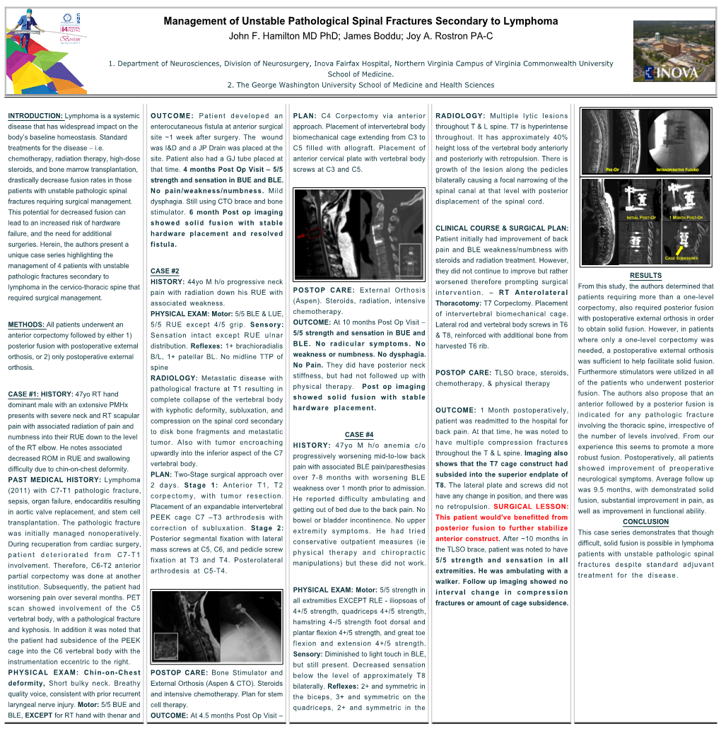 Management of Unstable Pathological Spinal Fractures Secondary to Lymphoma John F