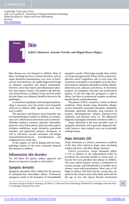 Inflammatory Skin Disorders Spongiotic Dermatitis Atopic