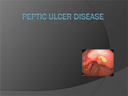 The Duodenal Ulcer Is the Chronic Recurrent Disease Which Is Characterized by Ulcer Defect on a Mucosa of the Duodenum