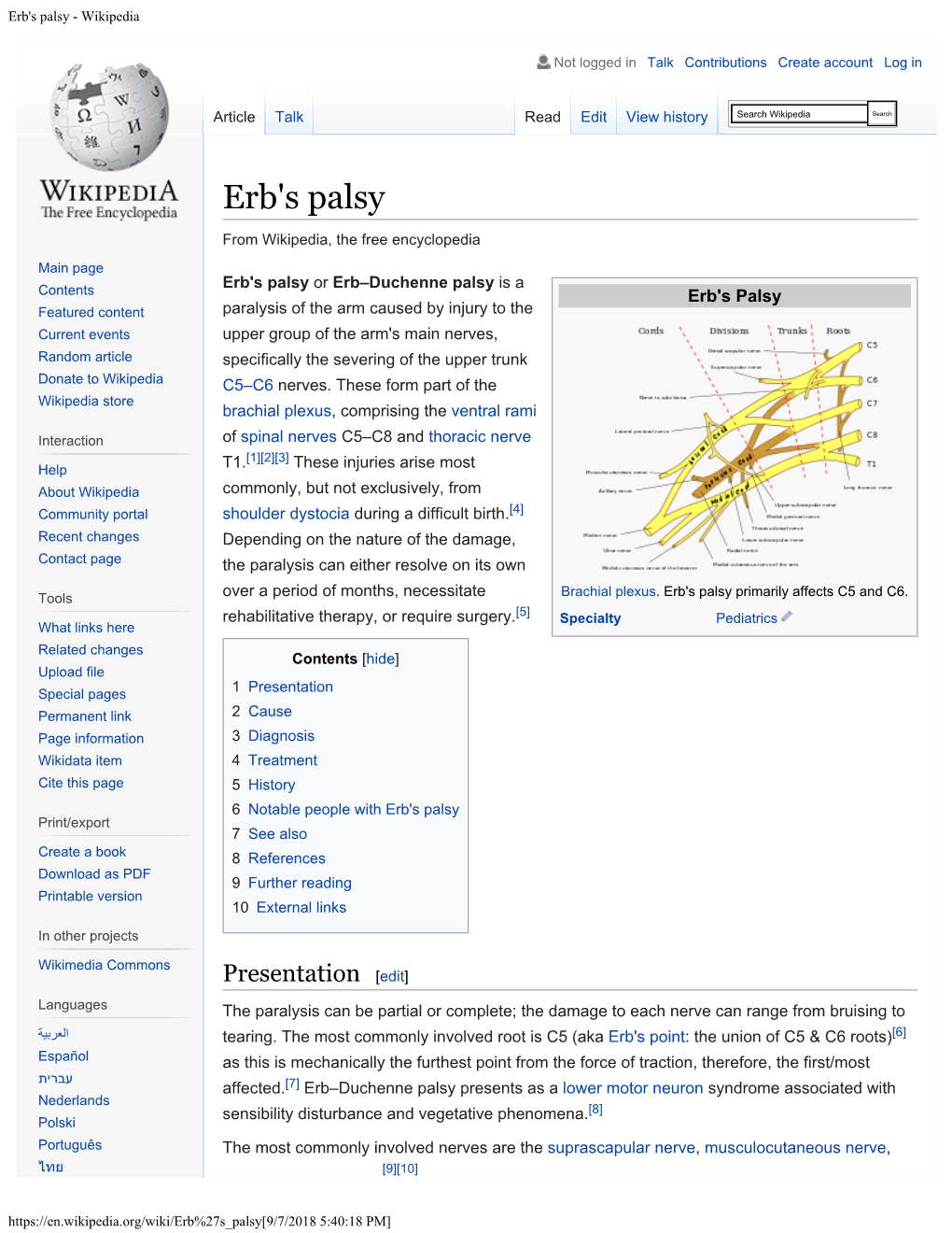 Erb's Palsy - Wikipedia