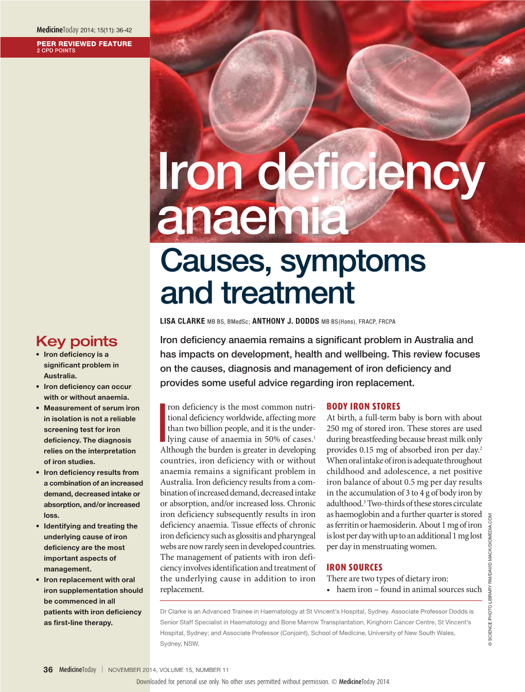 Iron Deficiency Anaemia. Causes, Symptoms and Treatment