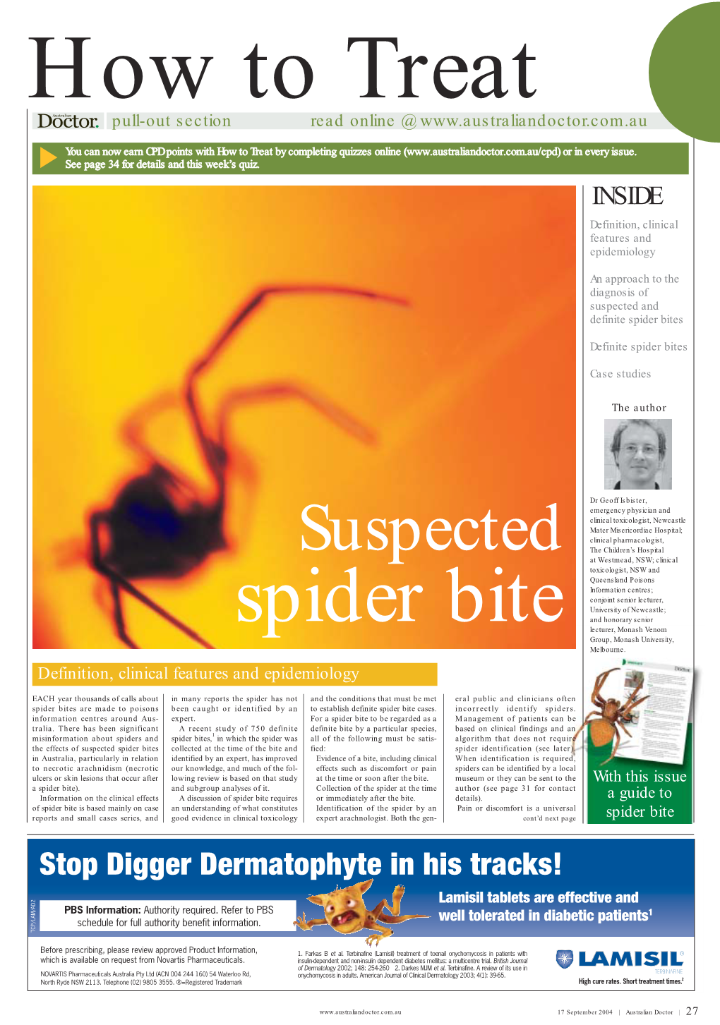 How to Treat a Suspected Spider Bite.Pdf
