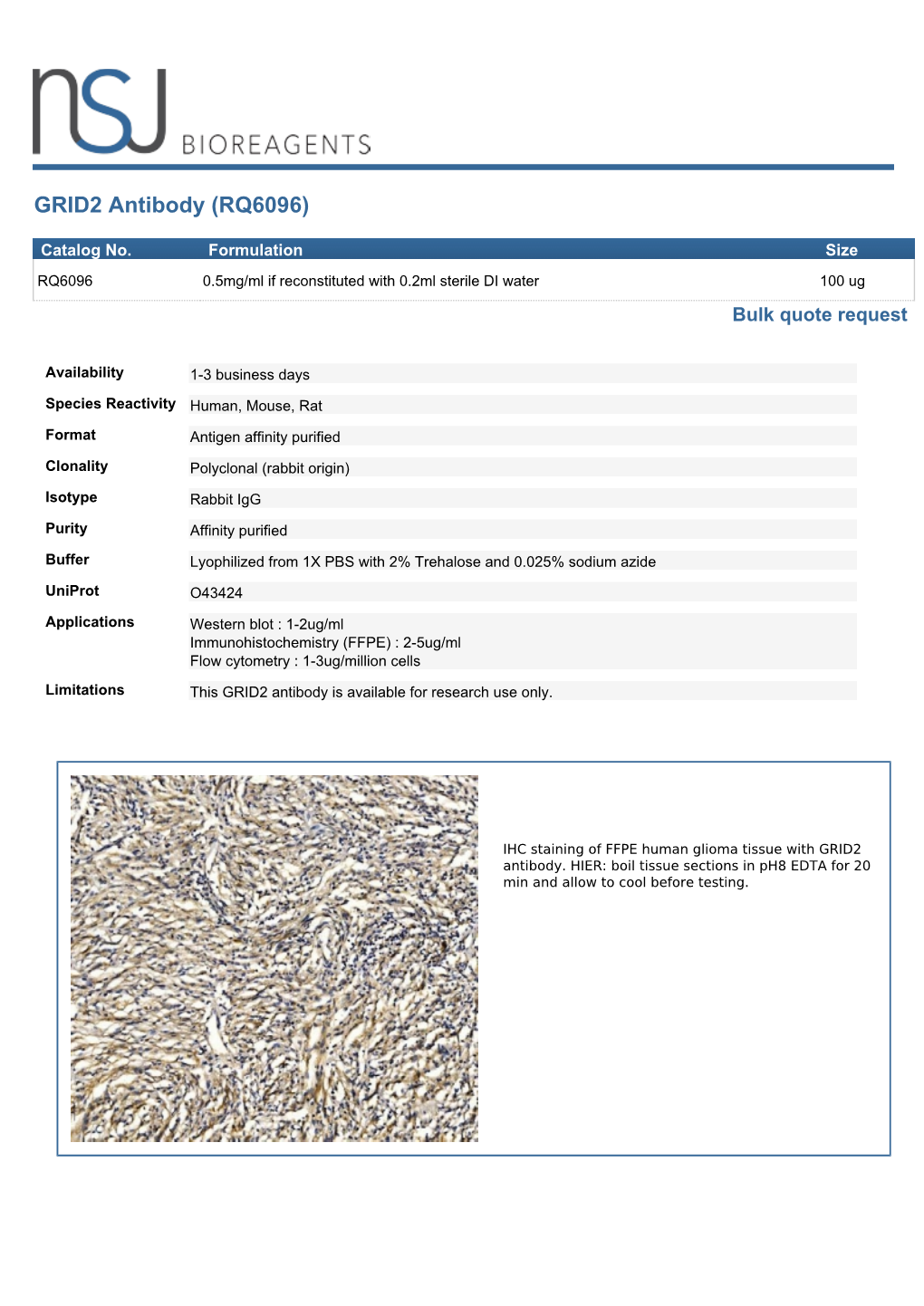 GRID2 Antibody (RQ6096)