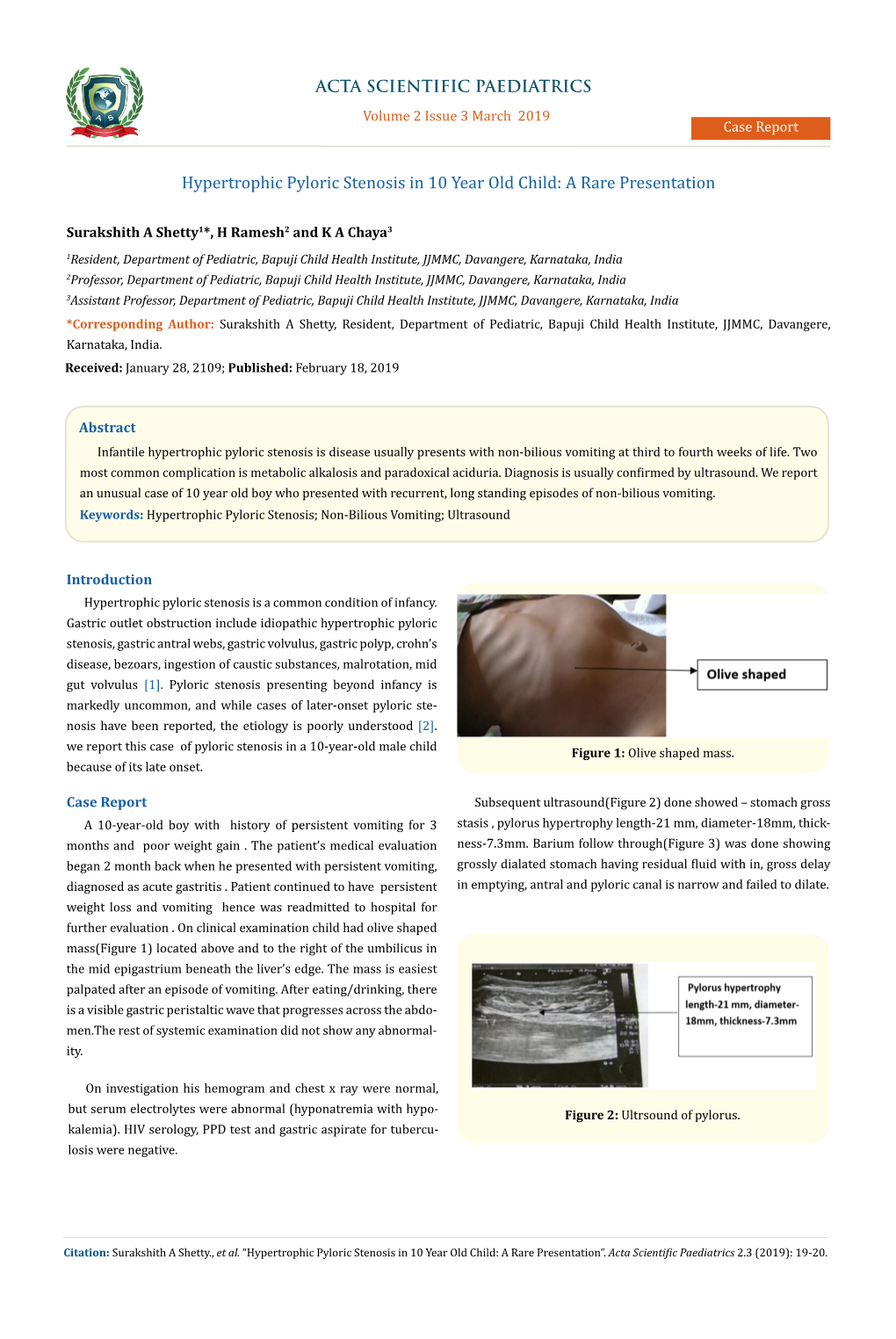 Hypertrophic Pyloric Stenosis in 10 Year Old Child: a Rare Presentation