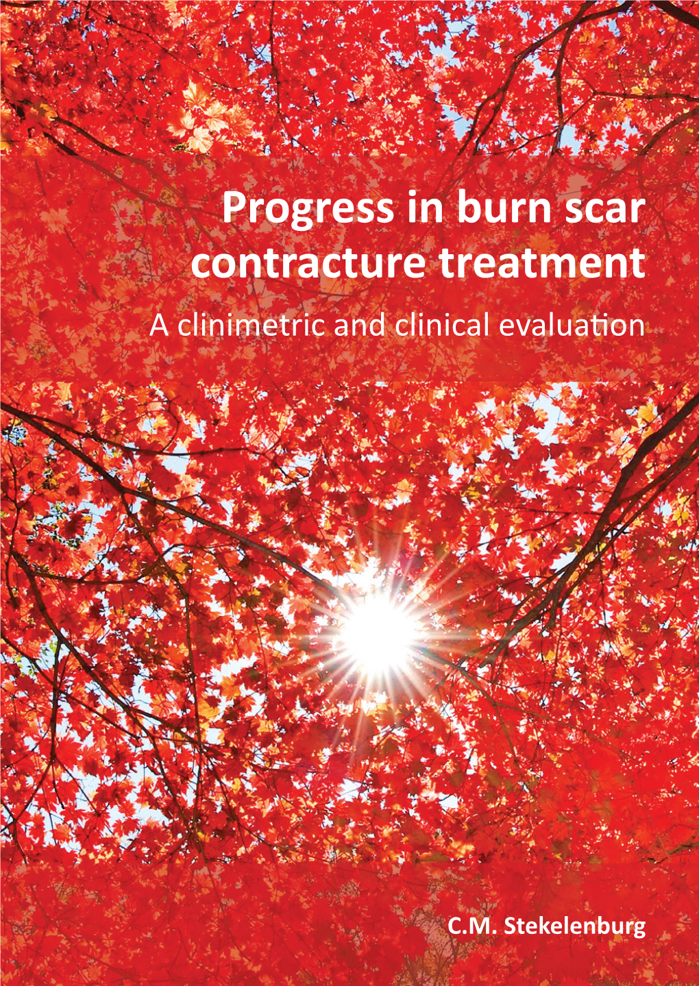 Progress in Burn Scar Contracture Treatment Openbare Verdediging Van Het Proefschrift